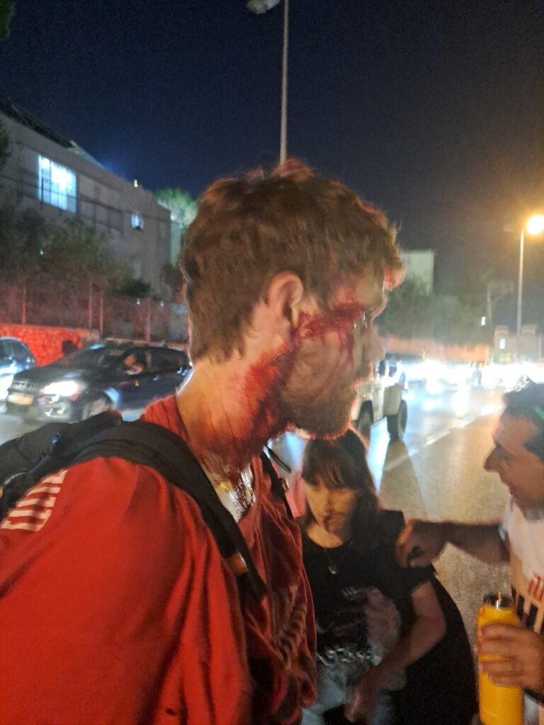מפגינים פצועים, הערב בכביש פרויד | צילום: פעילי משנים כיוון