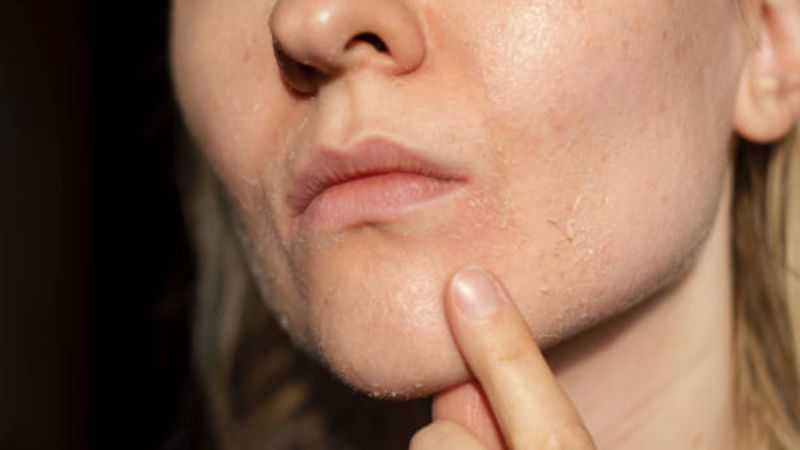 יובש בפנים | צילום: GETTYIMAGE