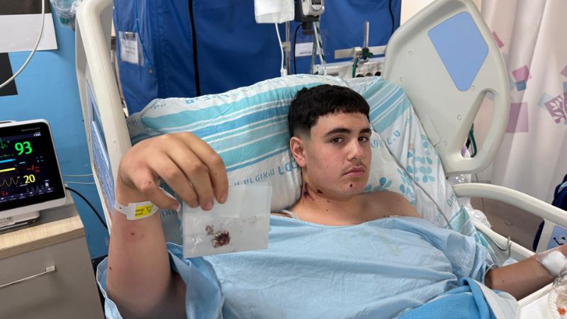 חייו של הנער ניצלו בנס: המנתחים חילצו מצווארו שני רסיסים, מילימטר מהעורק הראשי