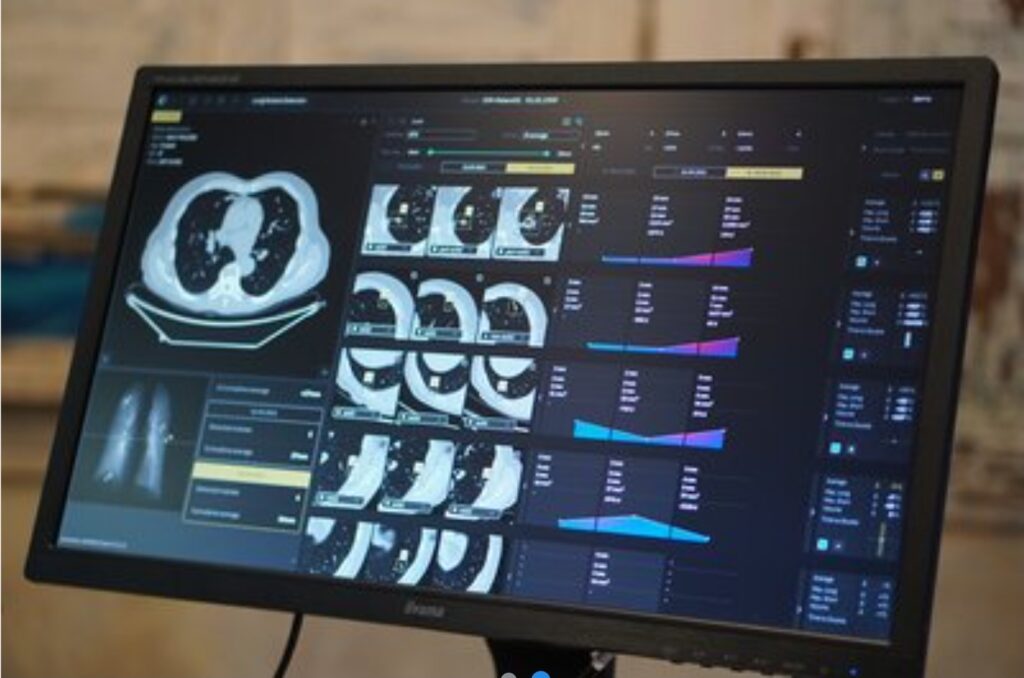 מערכת Context Flow | צילום: דוברות ביה