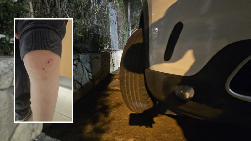 גלגל המכונית, המעבר הצר להולכי רגל והברך הפצועה | צילום: אלבום פרטי